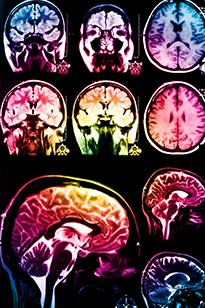 Цветные рентгеновские снимки мозга