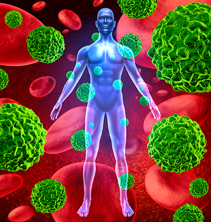 Тело человека, распространение и рост раковых клеток